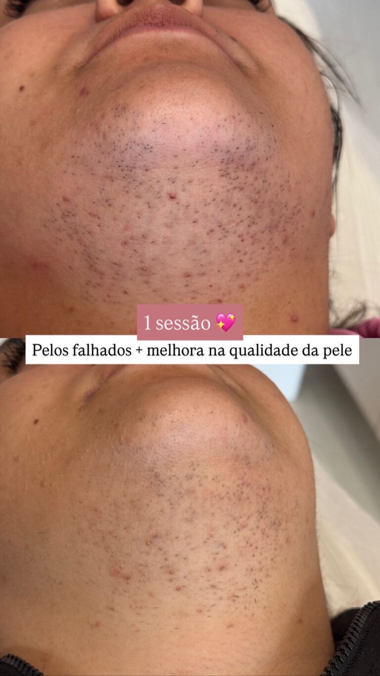 dp03
