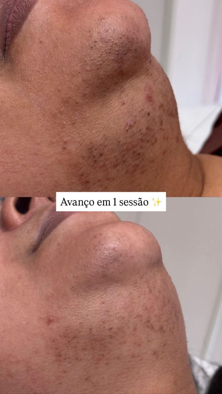 sop08